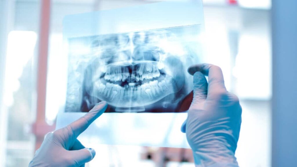 A Response to the New York Times: You Probably Need Dental X-Rays